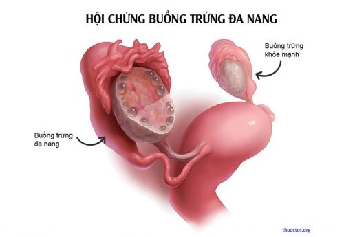 Emysitol giúp điều hòa kinh nguyệt, điều hòa nội tiết, điều hòa rụng trứng